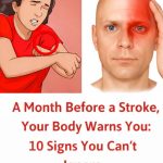 A month before a stroke, your body warns you: 10 signs not to ignore
