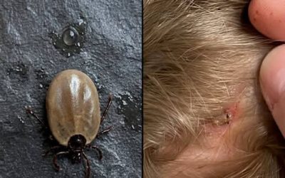 Does anyone know what kind of insect this is? I just found it on my son’s head…