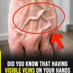 Did you know that having visible veins means you are… See more